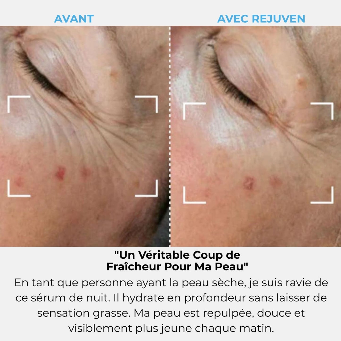 Abonnement Rejuven